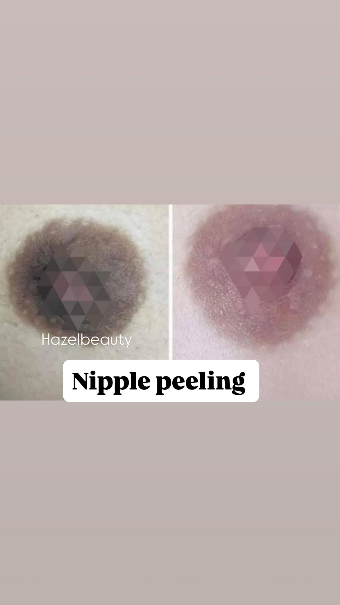 Body Treatment