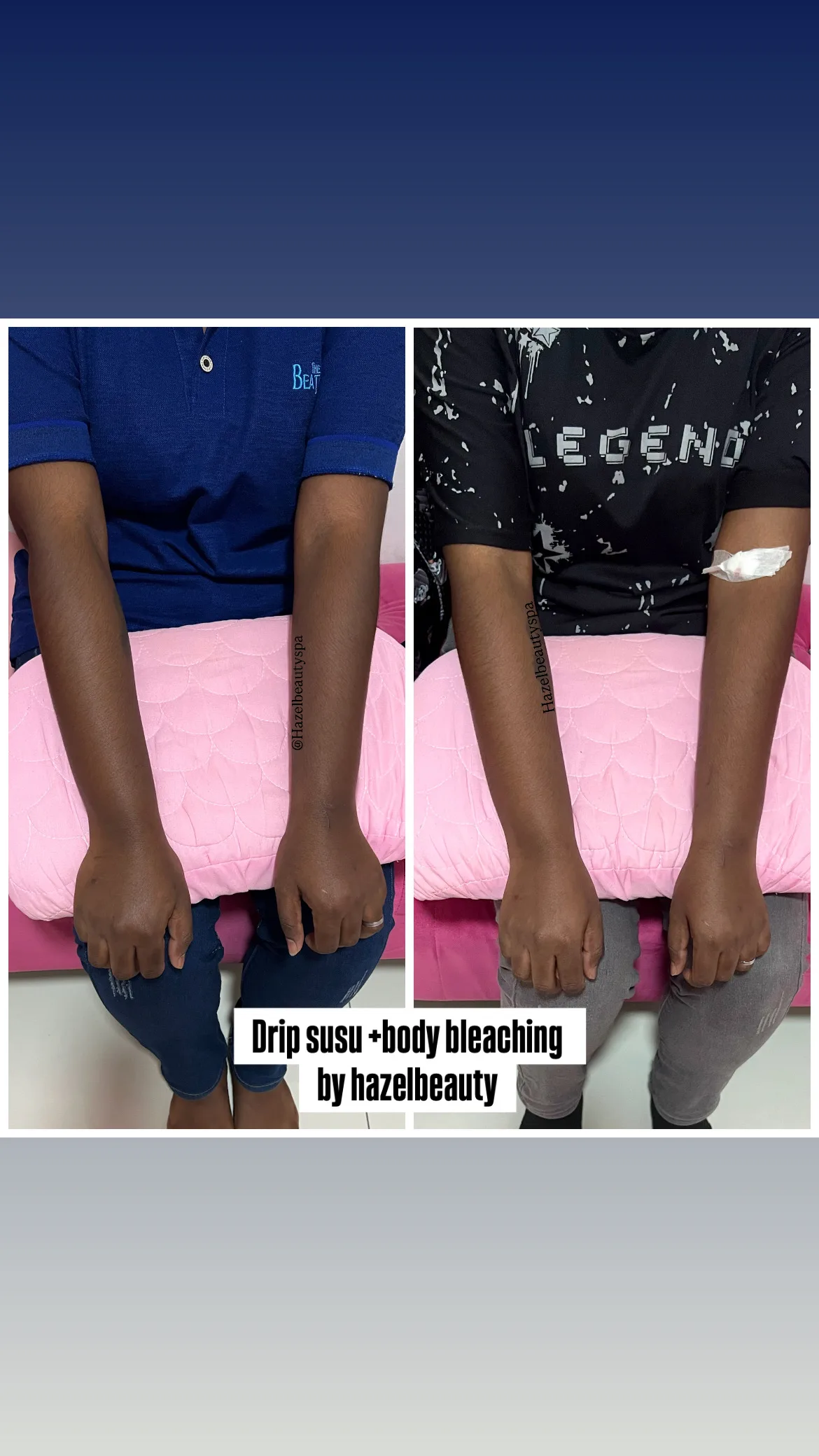 Body Treatment