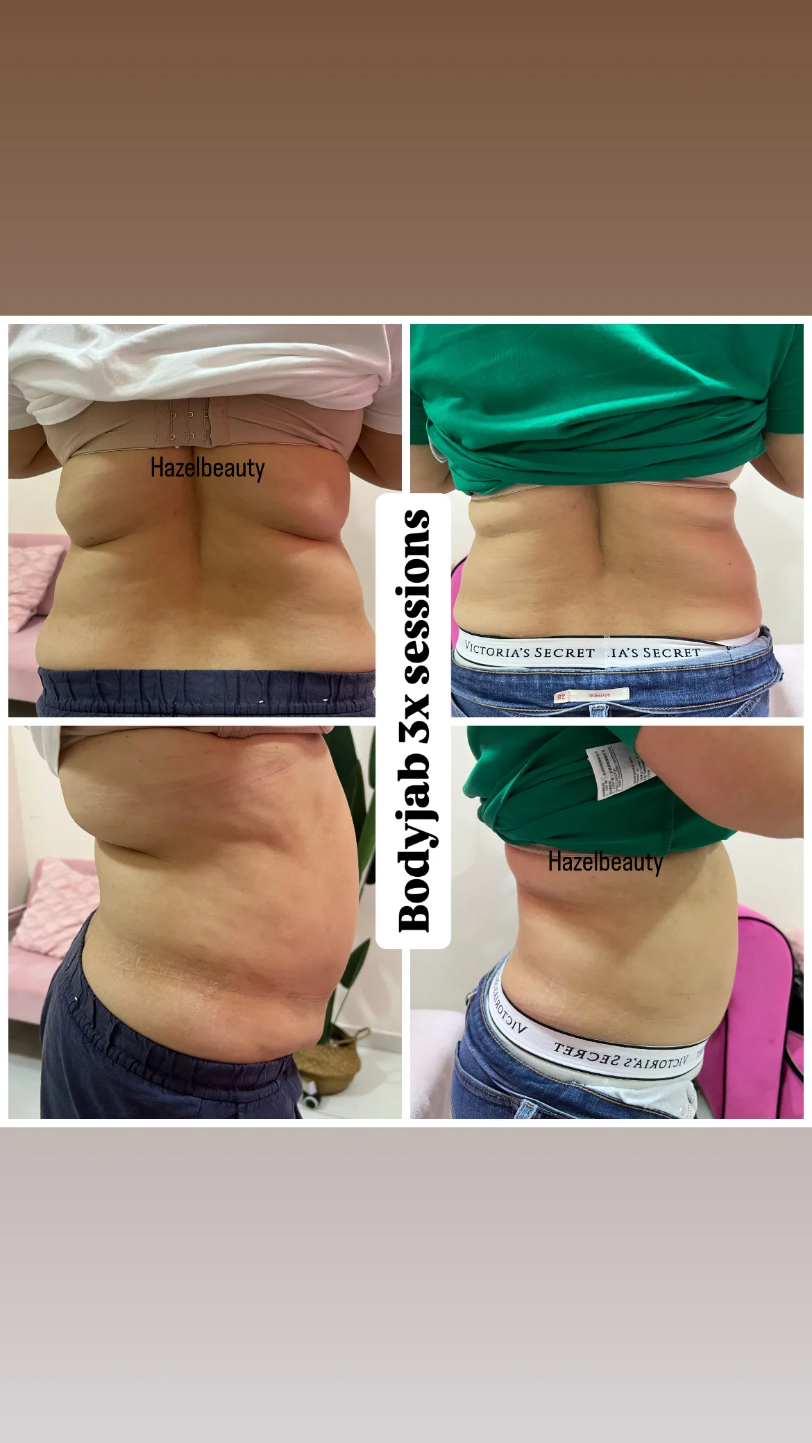 Body Treatments