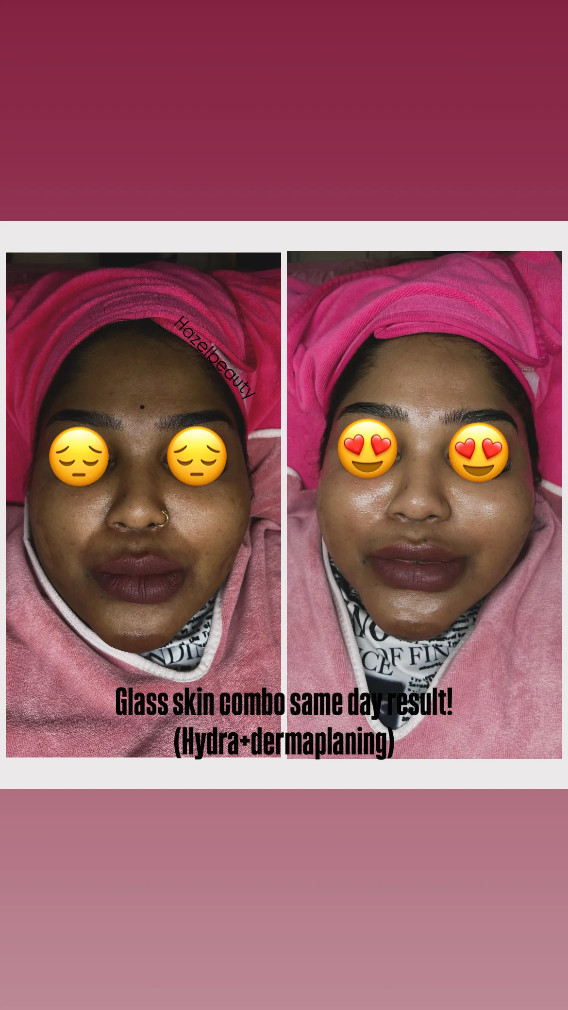 Facial Treatment
