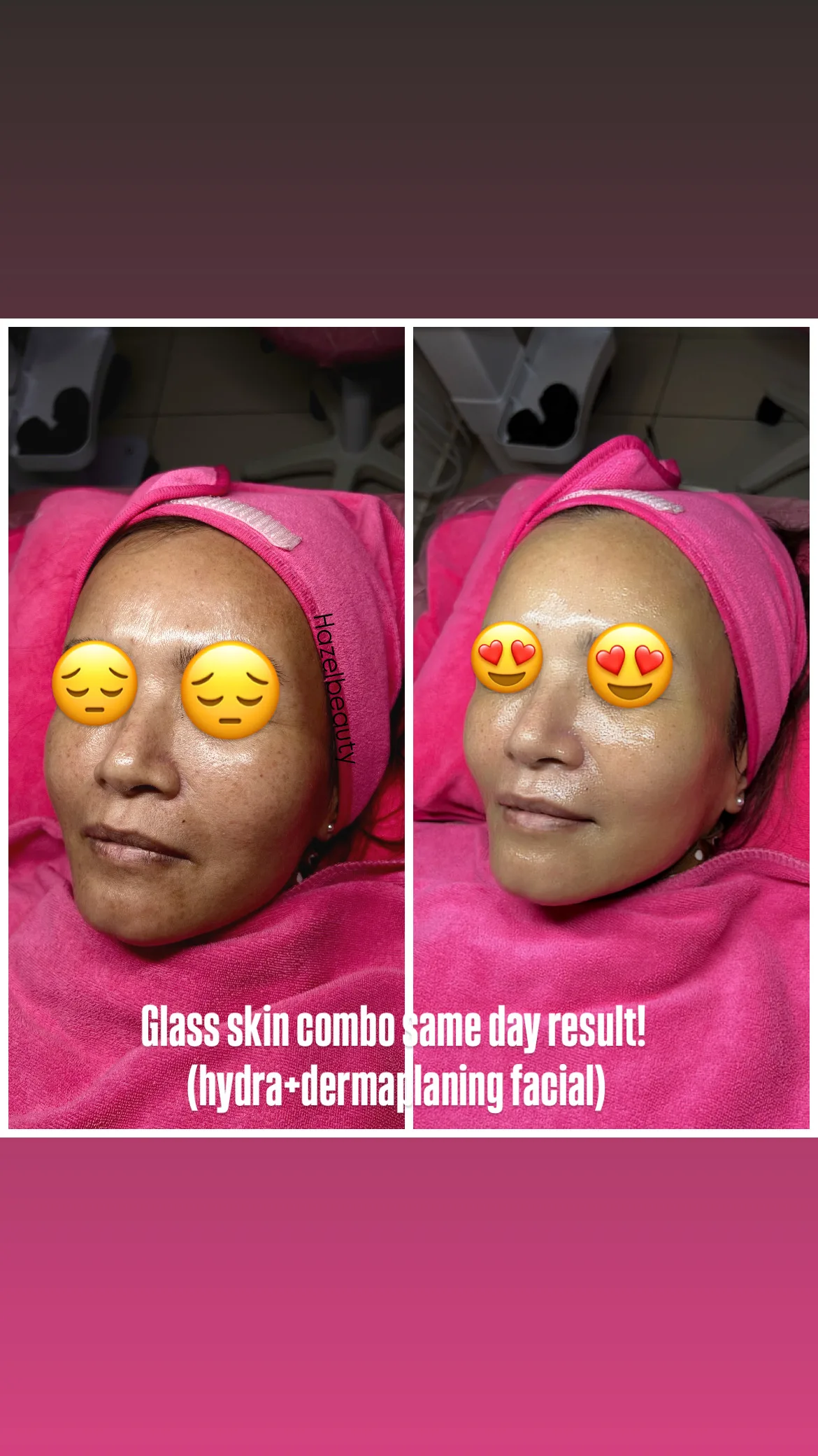 Facial Treatment