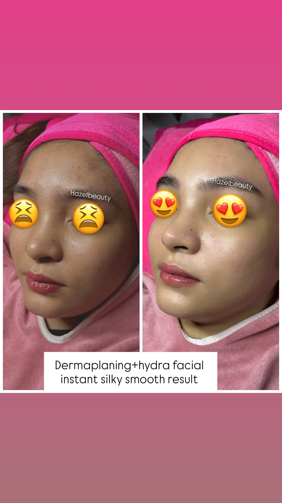 Facial Treatment