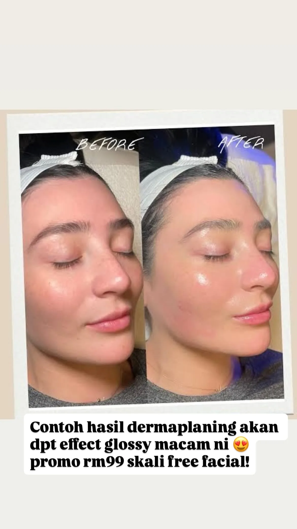 Facial Treatment