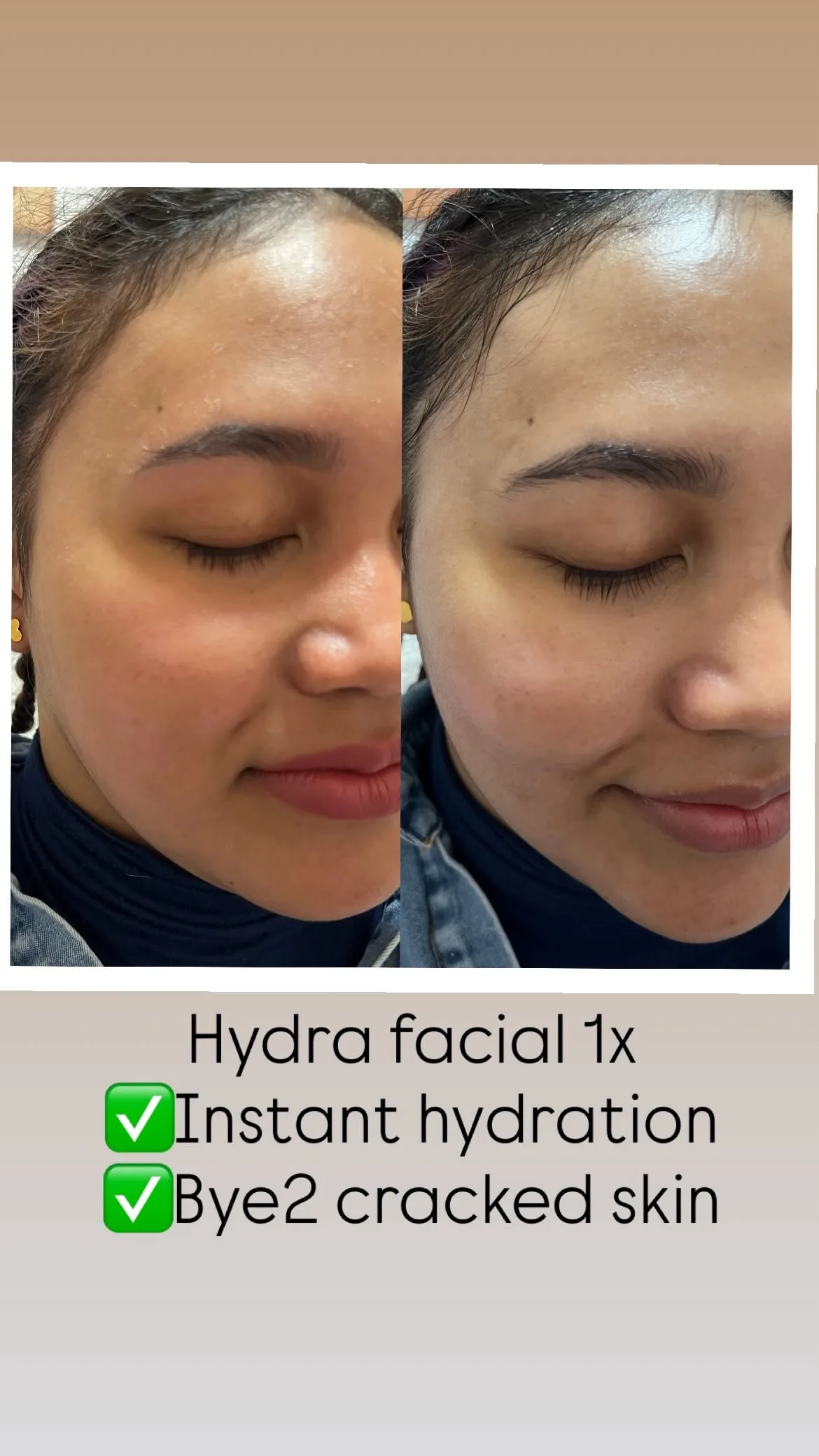 Facial Treatment