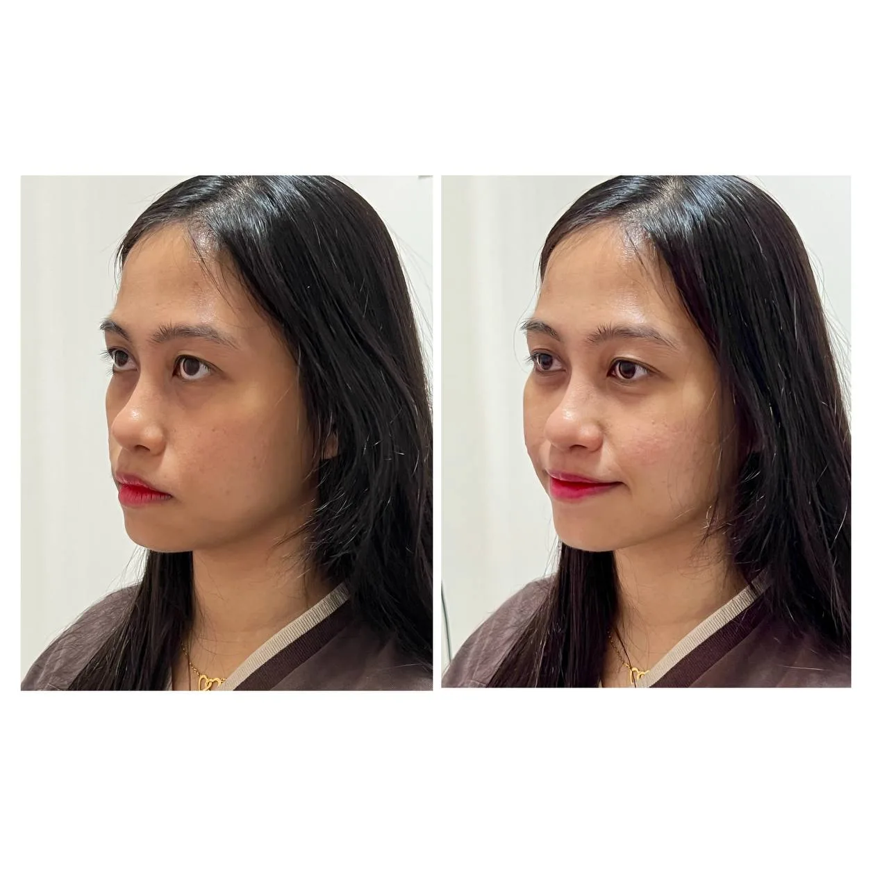Facial