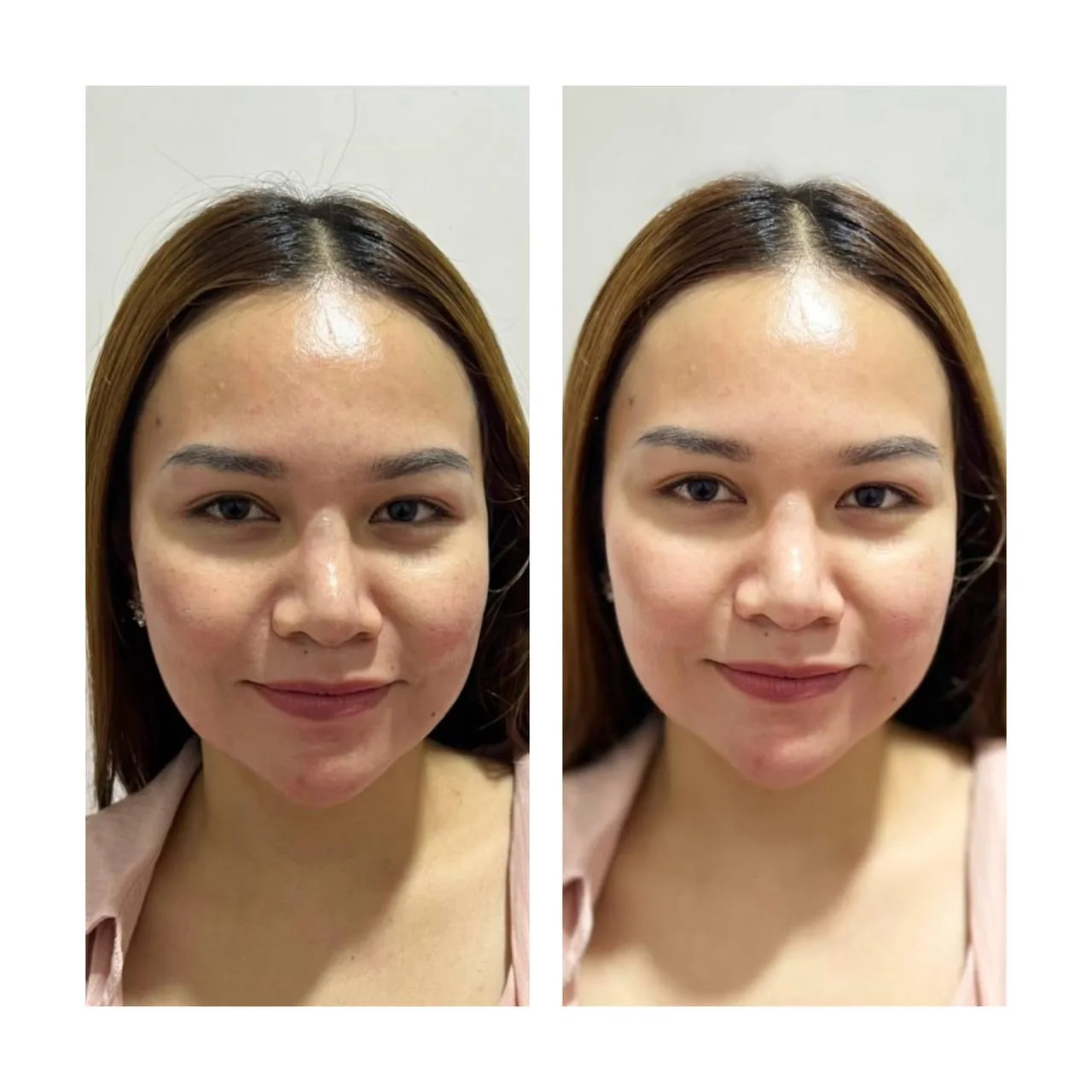 Facial