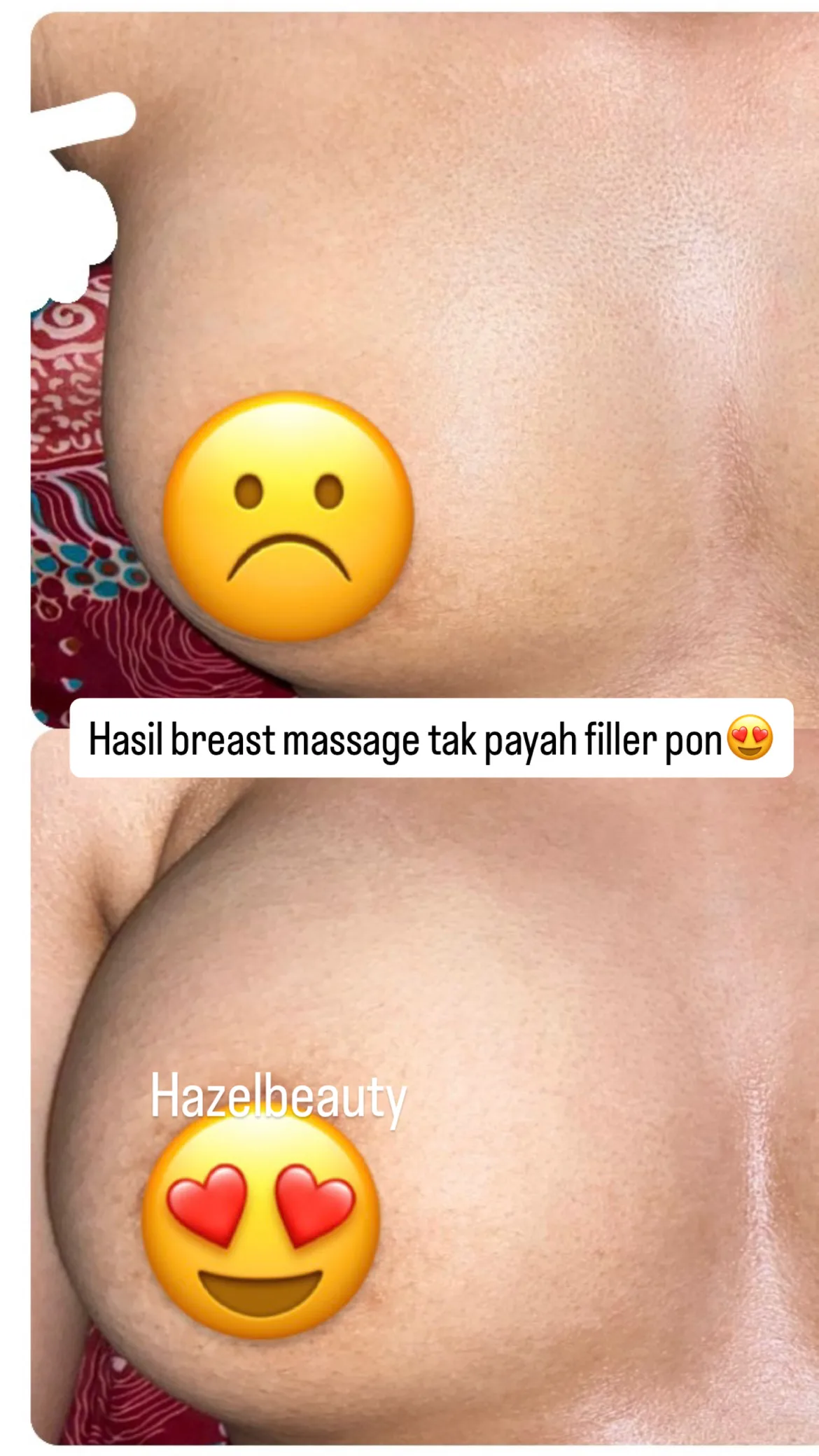 Massage Treatment