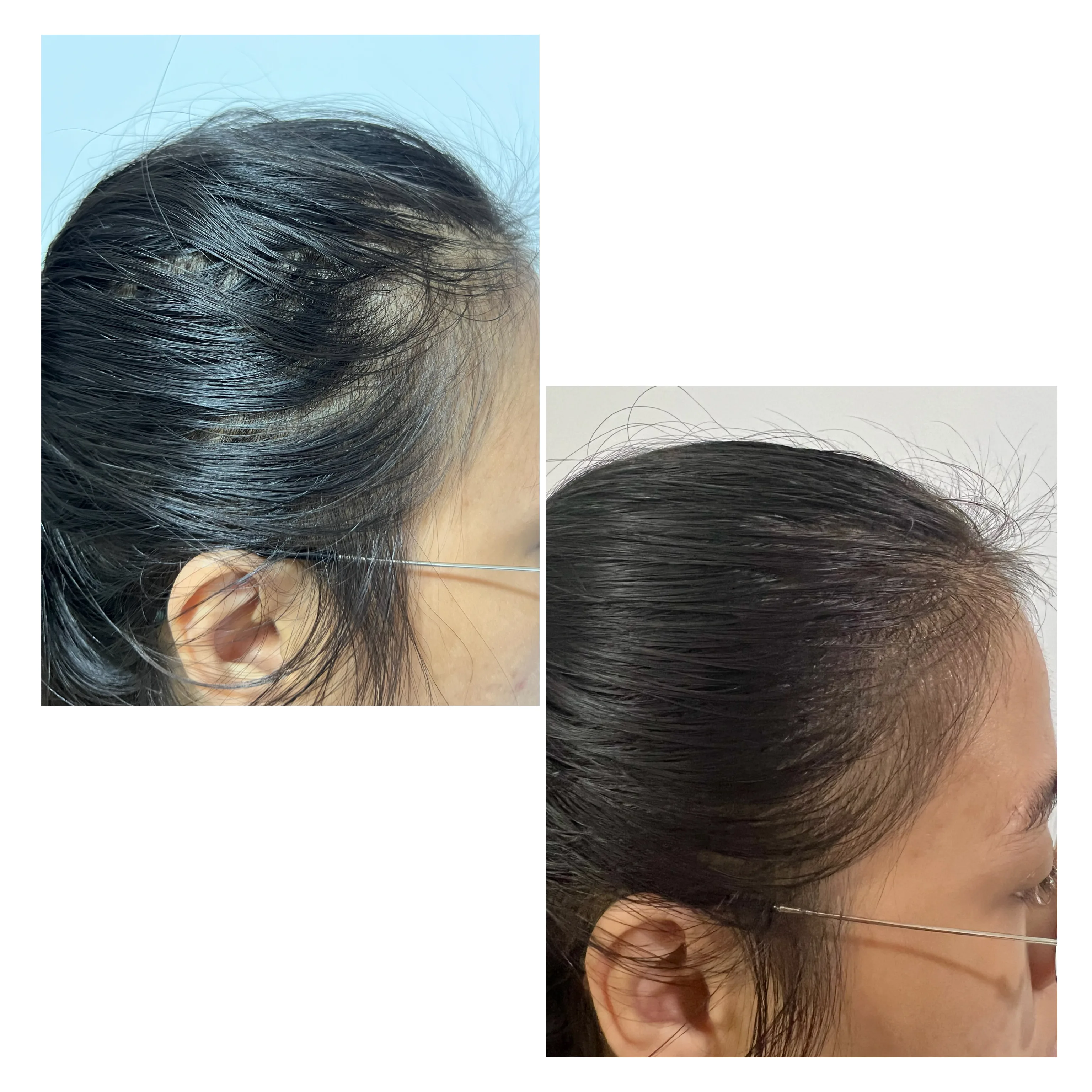 Other Treatments