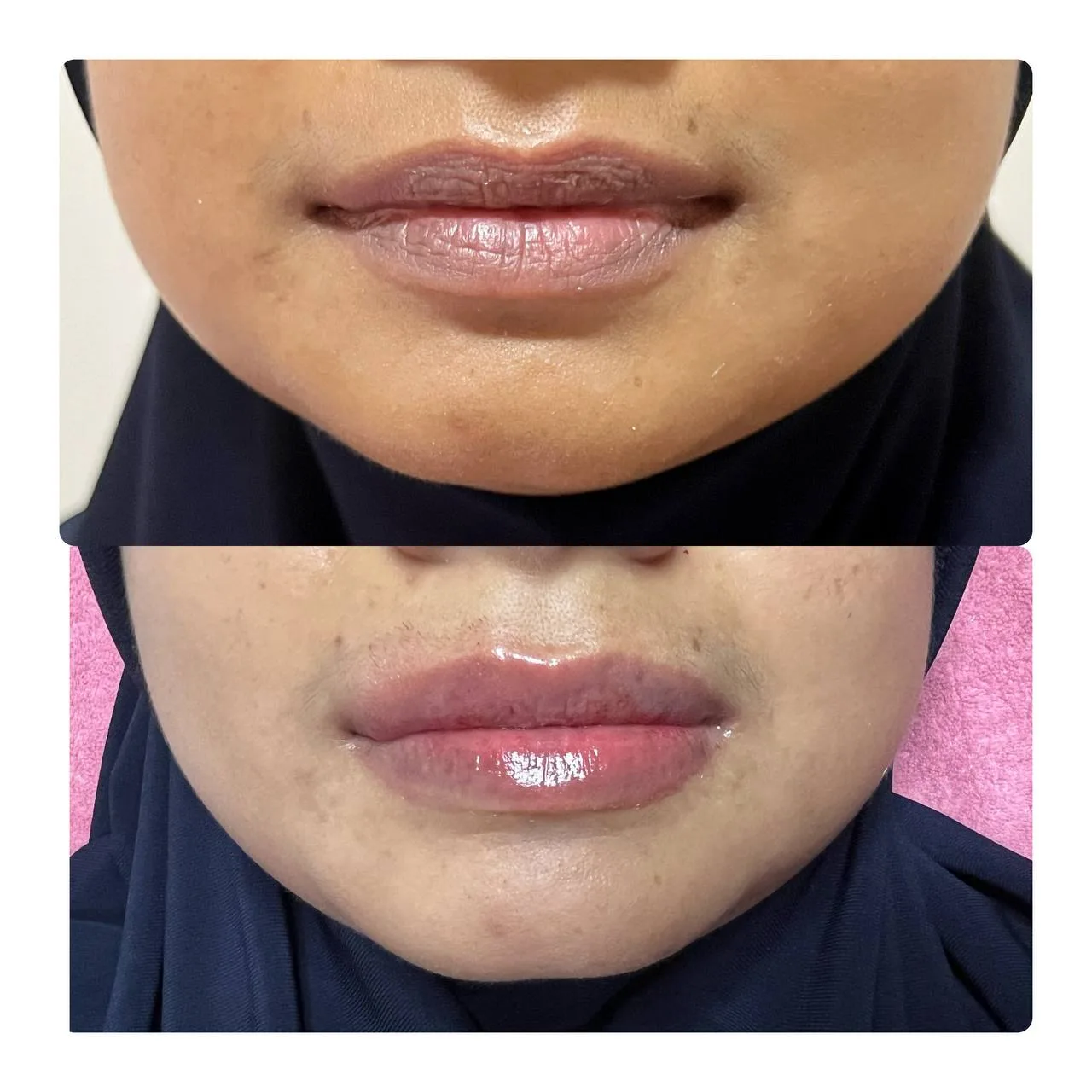 Other Treatments