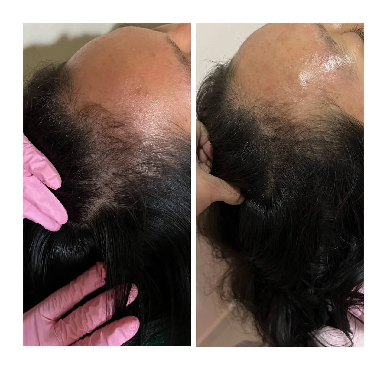 Other Treatments